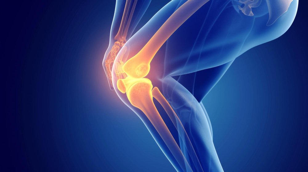 Osteoarthritis